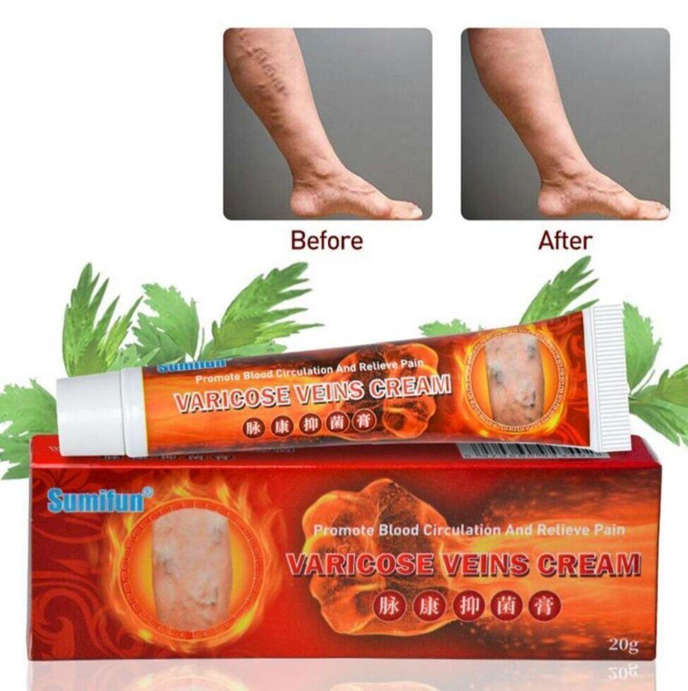 Крем против варикозного расширения вен Varicose Veins Sumifun
