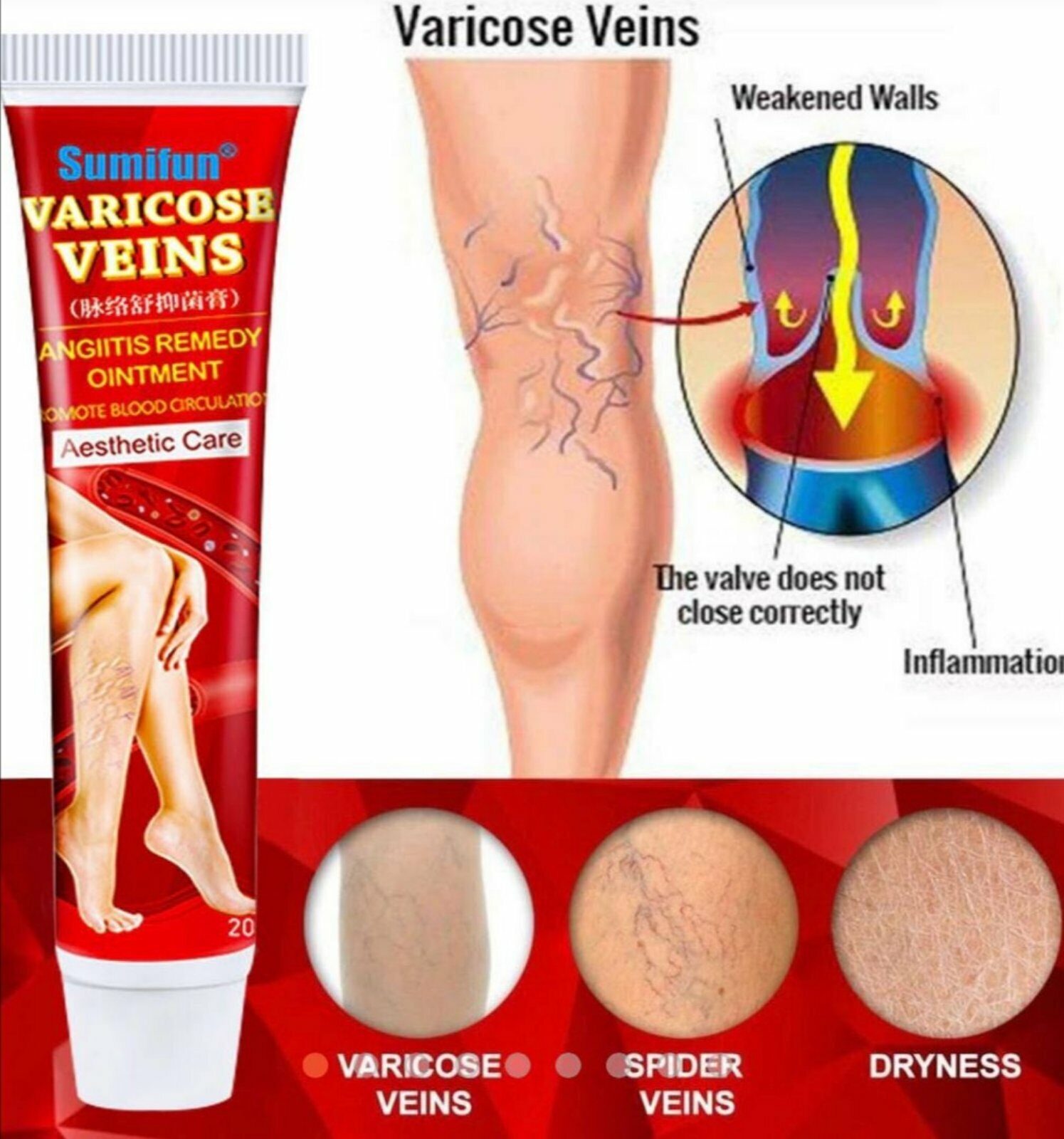 Мазь против варикозного расширения вен Sumifun Varicose Veins